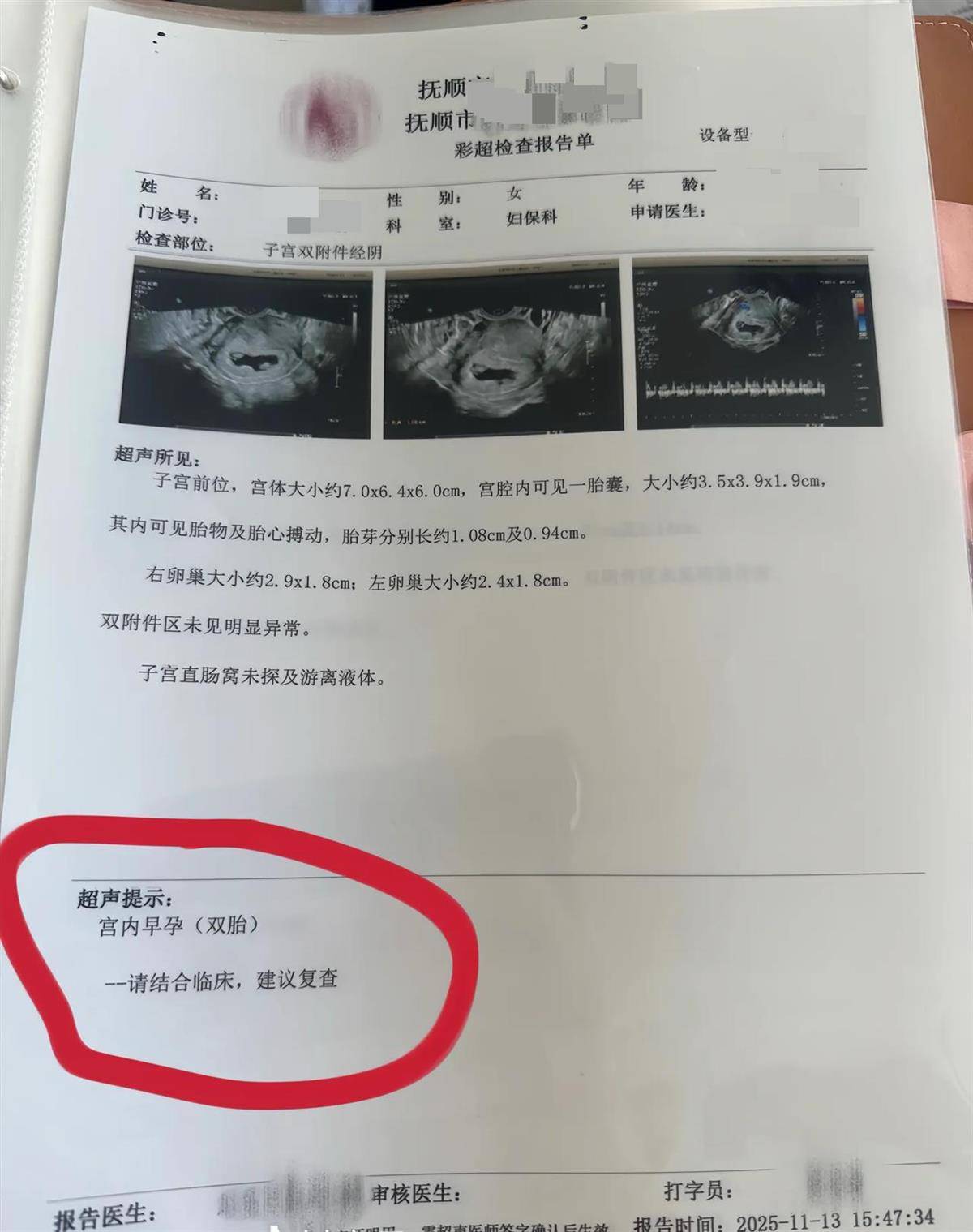 辽宁一孕妇两个月内从一胎变四胞胎,每次产检发现多出一胎,医生:系同卵四胞胎,概率1300万至1500万分之一